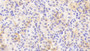 DAB staining on fromalin fixed paraffin- embedded Kidney tissue)