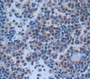 P53 Upregulated Modulator Of Apoptosis (Puma) Polyclonal Antibody, Cat#CAU25080