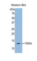 Western Blot; Sample: Recombinant protein.