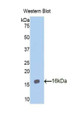 Western Blot; Sample: Recombinant protein.