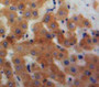 Used in DAB staining on fromalin fixed paraffin-embedded Liver tissue