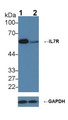 Knockout Varification: &lt;br/&gt;Lane 1: Wild-type K562 cell lysate; &lt;br/&gt;Lane 2: IL7R knockout K562 cell lysate; &lt;br/&gt;Predicted MW: 51,34,29kDa &lt;br/&gt;Observed MW: 60kDa&lt;br/&gt;Primary Ab: 2µg/ml Rabbit Anti-Human IL7R Ab&lt;br/&gt;Second Ab: 0.2µg/mL HRP-Linked Caprine Anti-Rabbit IgG Polyclonal Antibody&lt;br/&gt;