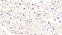 DAB staining on IHC-P; Samples: Human Cardiac Muscle Tissue;  Primary Ab: 20μg/ml Rabbit Anti-Human CDHH Antibody Second Ab: 2µg/mL HRP-Linked Caprine Anti-Rabbit IgG Polyclonal Antibody 