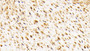 DAB staining on IHC-P; Samples: Human Placenta Tissue; Primary Ab: 10μg/ml Rabbit Anti-Human OSC Antibody Second Ab: 2µg/mL HRP-Linked Caprine Anti-Rabbit IgG Polyclonal Antibody