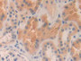 DAB staining on IHC-P; Samples: Human Kidney Tissue; Primary Ab: 10µg/ml Rabbit Anti-Human MMP24 Antibody Second Ab: 2µg/mL HRP-Linked Caprine Anti-Rabbit IgG Polyclonal Antibody