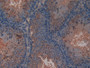 DAB staining on IHC-P; Samples: Mouse Testis Tissue; Primary Ab: 10µg/ml Rabbit Anti-Mouse VEGFR3 Antibody Second Ab: 2µg/mL HRP-Linked Caprine Anti-Rabbit IgG Polyclonal Antibody