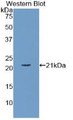 Western Blot; Sample: Recombinant protein.