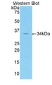 Western Blot; Sample: Recombinant protein.