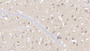 DAB staining on IHC-P; Samples: Human Cerebrum Tissue; Primary Ab: 20µg/ml Rabbit Anti-Human CDK1 Antibody Second Ab: 2µg/mL HRP-Linked Caprine Anti-Rabbit IgG Polyclonal Antibody