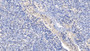 DAB staining on IHC-P. Samples: Human Tissue)