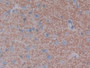 DAB staining on fromalin fixed paraffin- embedded intestine tissue)