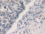 DAB staining on fromalin fixed paraffin-embedded Liver tissue)