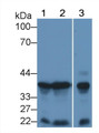 Western Blot; Sample: Lane1: Mouse Liver lysate; Lane2: Mouse Lung lysate; Lane3: Hela cell lysate; Primary Ab: 1μg/ml Rabbit Anti-Mouse FGF10 Antibody; Second Ab: 0.2µg/mL HRP-Linked Caprine Anti-Rabbit IgG Polyclonal Antibody;
