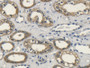 DAB staining on IHC-P; Samples: Human Kidney Tissue; Primary Ab: 20µg/ml Rabbit Anti-Human FGF10 Antibody Second Ab: 2µg/mL HRP-Linked Caprine Anti-Rabbit IgG Polyclonal Antibody