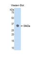 Western Blot; Sample: Recombinant protein.