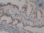 DAB staining on IHC-P; Samples: Mouse Ovary Tissue; Primary Ab: 10µg/ml Rabbit Anti-Mouse HMGN1 Antibody Second Ab: 2µg/mL HRP-Linked Caprine Anti-Rabbit IgG Polyclonal Antibody