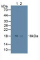 Western Blot; Sample: Lane1: Human HepG2 Cells; Lane2: Human Hela Cells.