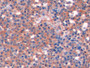 DAB staining on fromalin fixed paraffin-embedded Kidney tissue)