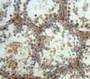 Used in DAB staining on fromalin fixed paraffin-embedded Testis tissue