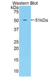 Western Blot; Sample: Recombinant protein.