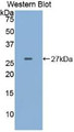 Western Blot; Sample: Recombinant protein.