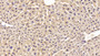 Fetuin B (Fetub) Polyclonal Antibody, Cat#CAU25175