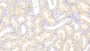 DAB staining on IHC-P; Samples: Human Kidney Tissue;  Primary Ab: 20μg/ml Rabbit Anti-Human LOX1 Antibody Second Ab: 2µg/mL HRP-Linked Caprine Anti-Rabbit IgG Polyclonal Antibody 