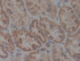 DAB staining on IHC-P; Samples: Human Kidney Tissue;  Primary Ab: 10µg/ml Rabbit Anti-Human IkBb Ant