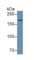 Western Blot; Sample:Human Lung lysate; Primary Ab: 2µg/ml Rabbit Anti-Mouse VCL Antibody Second Ab: 0.2µg/mL HRP-Linked Caprine Anti-Rabbit IgG Polyclonal Antibody