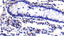 DAB staining on IHC-P; Sample: Porcine Colon Tissue; Primary Ab: 20ug/ml Rabbit Anti-Porcine IL2Ra Antibody Second Ab: 2µg/mL HRP-Linked Caprine Anti-Rabbit IgG Polyclonal Antibody