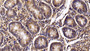 DAB staining on IHC-P; Sample: Bovine Small intestine Tissue; Primary Ab: 10μg/ml Rabbit Anti-Bovine IL2Ra Antibody Second Ab: 2µg/mL HRP-Linked Caprine Anti-Rabbit IgG Polyclonal Antibody