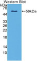 Western Blot Sample: Recombinant Ntn4, Human