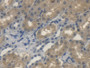 DAB staining on IHC-P; Samples: Rat Kidney Tissue; Primary Ab: 20µg/ml Rabbit Anti-Rat SHH Antibody Second Ab: 2µg/mL HRP-Linked Caprine Anti-Rabbit IgG Polyclonal Antibody