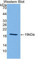 Western Blot; Sample: Recombinant protein.