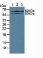 Western Blot; Sample: Lane1: Human Liver Tissue; Lane2: Mouse Kidney Tissue; Lane3: Human PANC-1 Cells.