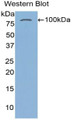 Western Blot; Sample: Recombinant protein.