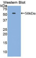 Western Blot; Sample: Recombinant protein.