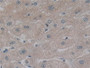 DAB staining on IHC-P; Samples: Human Liver Tissue; Primary Ab: 10µg/ml Rabbit Anti-Human NFkB Antibody Second Ab: 2µg/mL HRP-Linked Caprine Anti-Rabbit IgG Polyclonal Antibody