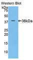 Western Blot; Sample: Recombinant protein.