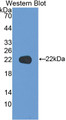 Western Blot; Sample: Recombinant protein.