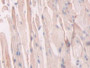 DAB staining on IHC-P; Samples: Mouse Stomach Tissue; Primary Ab: 20µg/ml Rabbit Anti-Mouse VEGFR1 Antibody Second Ab: 2µg/mL HRP-Linked Caprine Anti-Rabbit IgG Polyclonal Antibody