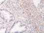 DAB staining on IHC-P; Samples: Mouse Uterus Tissue.