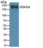 Western Blot; Sample: Mouse Heart Tissue.