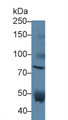 Western Blot; Sample: Human Serum; Primary Ab: 5µg/ml Rabbit Anti-Human VS Antibody Second Ab: 0.2µg/mL HRP-Linked Caprine Anti-Rabbit IgG Polyclonal Antibody