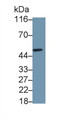 Western Blot; Sample: Jurkat cell lysate; Primary Ab: 0.4µg/ml Rabbit Anti-Rat IL6R Antibody; Second Ab: 0.2µg/mL HRP-Linked Caprine Anti-Rabbit IgG Polyclonal Antibody;