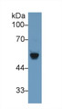 Western Blot; Sample: Rat Serum; Primary Ab: 1µg/ml Rabbit Anti-Rat bACE2 Antibody Second Ab: 0.2µg/mL HRP-Linked Caprine Anti-Rabbit IgG Polyclonal Antibody