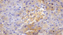 DAB staining on IHC-P; Samples: Mouse Pancreas Tissue; Primary Ab: 30μg/ml Rabbit Anti-Mouse bACE2 Antibody Second Ab: 2µg/mL HRP-Linked Caprine Anti-Rabbit IgG Polyclonal Antibody