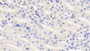 DAB staining on IHC-P; Samples: Mouse Kidney Tissue; Primary Ab: 20μg/ml Rabbit Anti-Mouse DBP Antibody Second Ab: 2µg/mL HRP-Linked Caprine Anti-Rabbit IgG Polyclonal Antibody