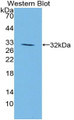 Western Blot; Sample: Recombinant protein.