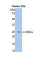 Western Blot; Sample: Recombinant protein.